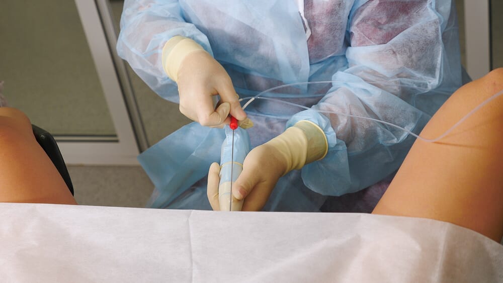 doctor performing an IUI procedure