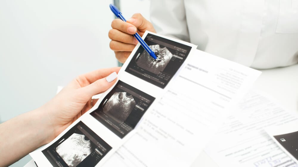 doctor consulting with patient about ultrasound photos