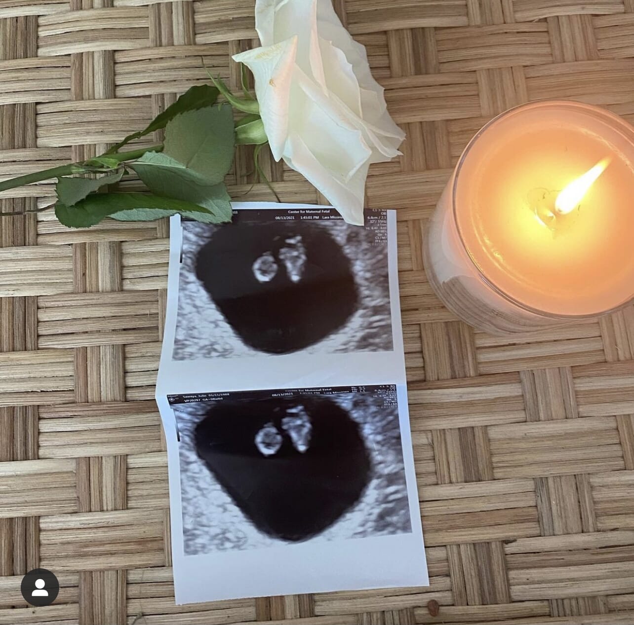 white rose next to ultrasound photos