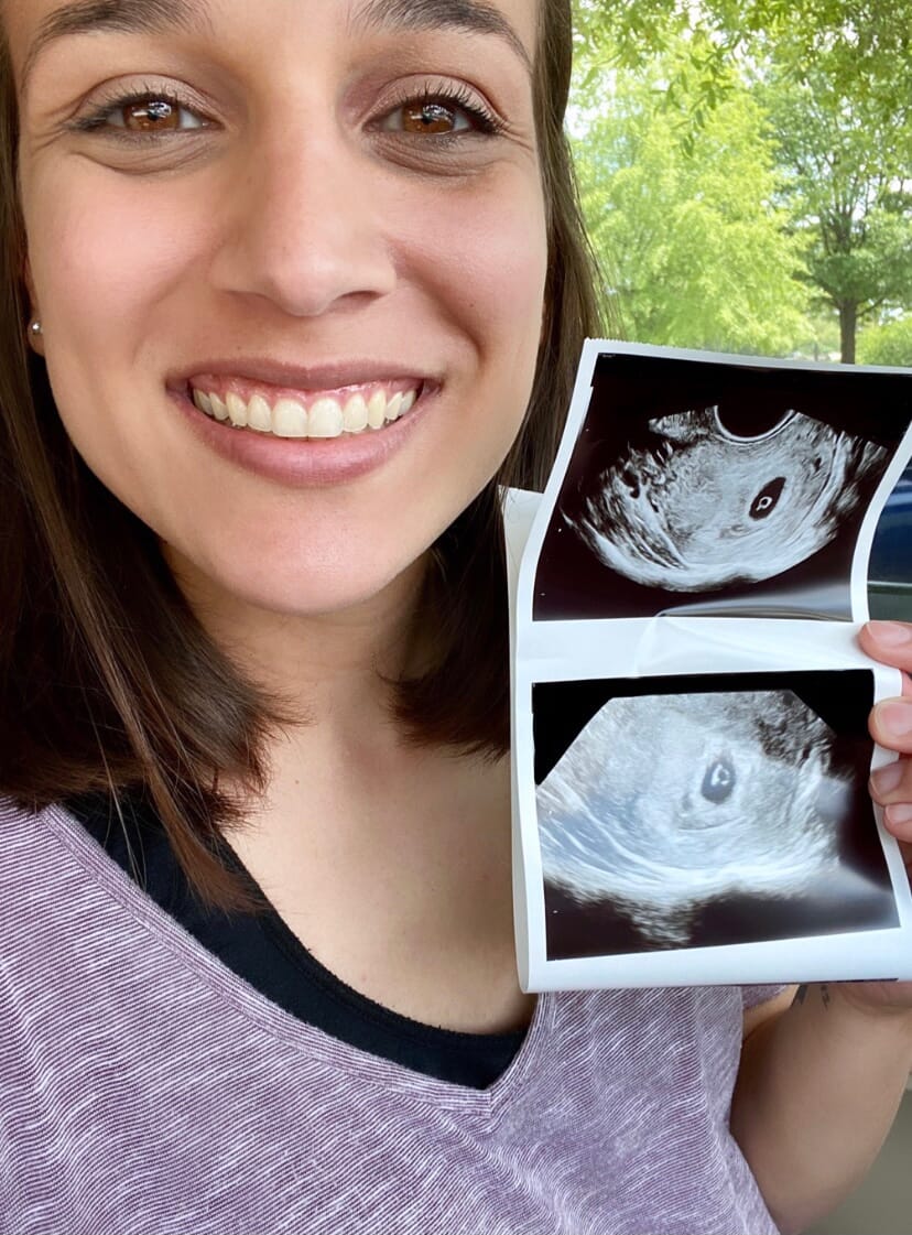 woman holding an ultrasound photo