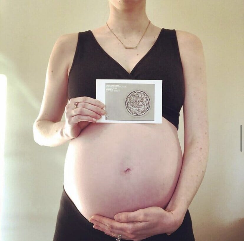 danielle repsch holding her pregnant belly and a picture of her embryo
