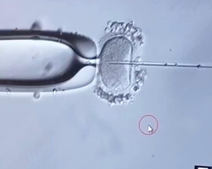 microscope image of egg retrieval