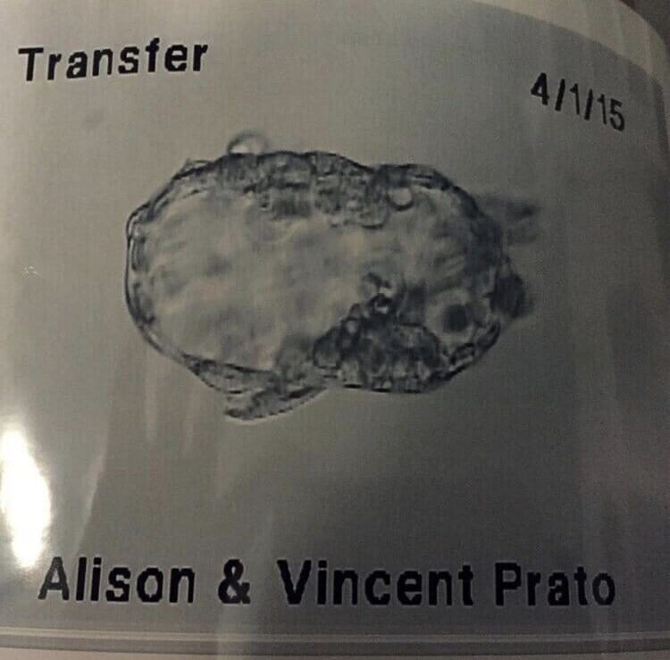 diagram of embryo transfer for alison and vincent prato